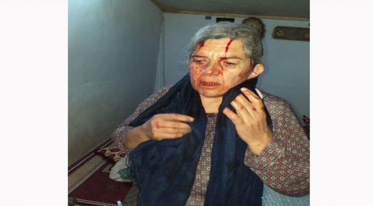 Çekdarên PYD êrîşî gundekî kirin û serê jineke kurd şikandin