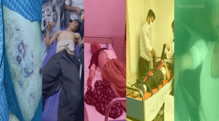 Supayê pasdaran bi tivengên nêçîrê 10 kolber birîndar kirin