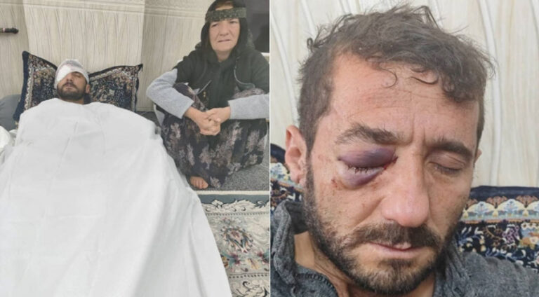 Kolberê ku ji aliyê hêzên Îranê ve hat birîndar kirin, çavê xwe ji dest da